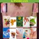Guide pratique psoriasis